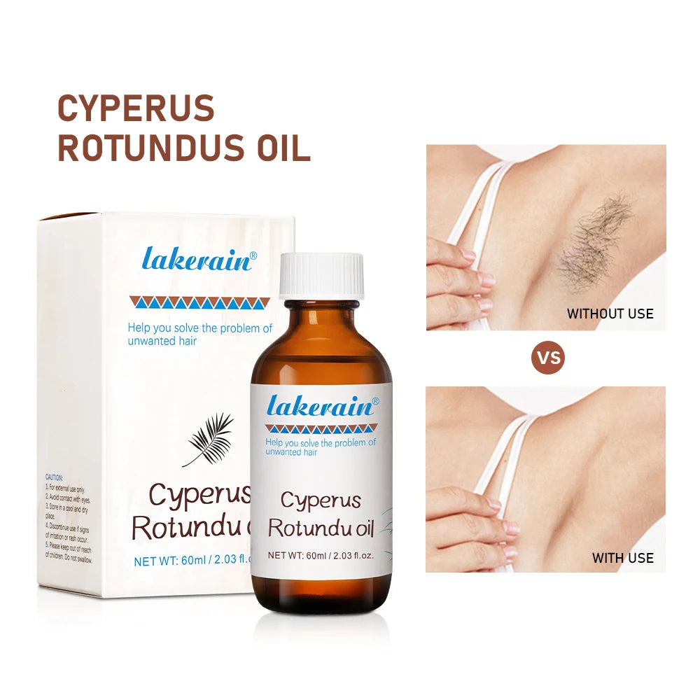 Inhibit Hair Growth 60ml Cyperus Rotundus Oil