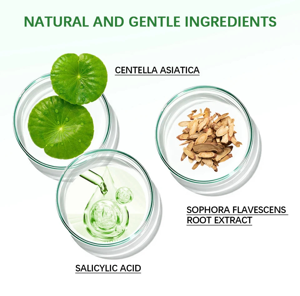 Acne Removal Balm Effective Fade Acne Spots Repair Gel Oil