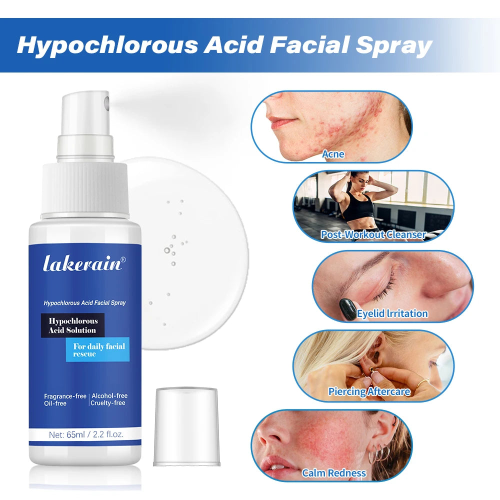 Hypochlorous Acid Facial Spray Reduce redness swelling acne Versatile