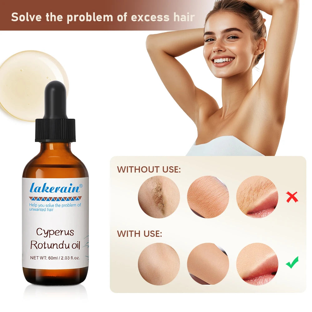Inhibit Hair Growth 60ml Cyperus Rotundus Oil