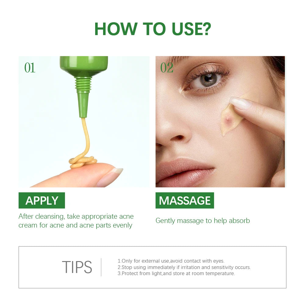 Acne Removal Balm Effective Fade Acne Spots Repair Gel Oil
