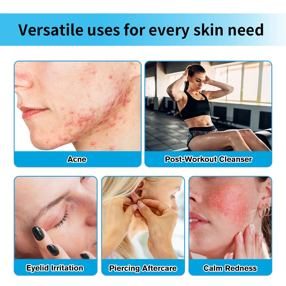 Hypochlorous Acid Facial Spray Reduce redness swelling acne Versatile