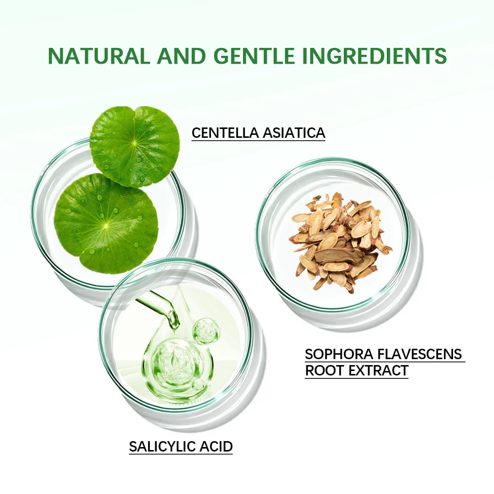 Acne Removal Balm Effective Fade Acne Spots Repair Gel Oil